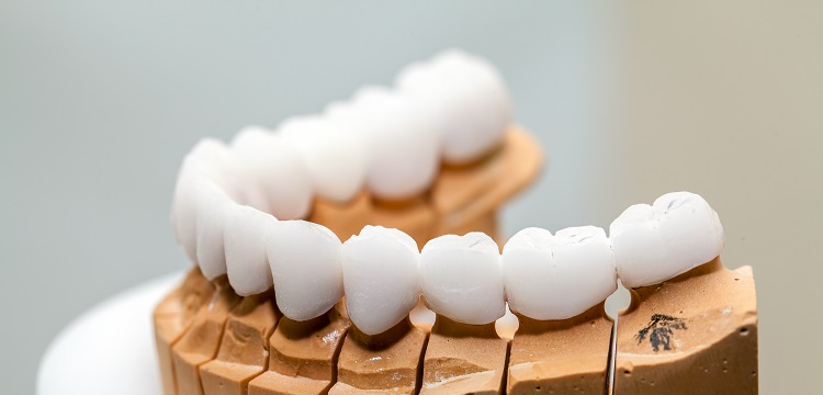 彎曲復(fù)原試驗