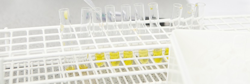 氰化物檢測(cè)