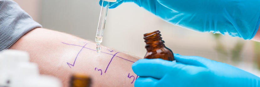 皮膚變態反應試驗