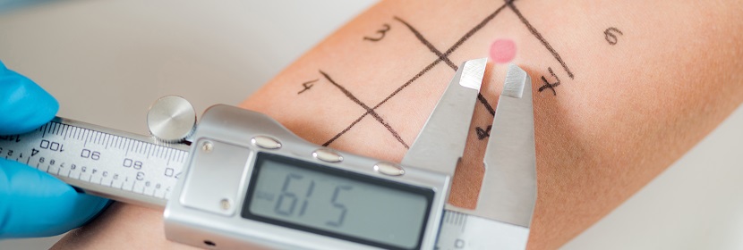 化妝品皮膚變態(tài)反應(yīng)試驗(yàn)